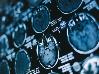Magnetic resonance scan of the brain. Medicine, science