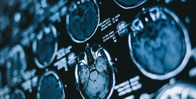 Magnetic resonance scan of the brain. Medicine, science